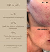 Better Together Set - Double Dose Serum and Fresh Start Essence FirstBase Skincare™