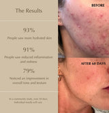FirstBase Duo Set before and after — reduced pigmentation, brighter and more hydrated skin in 30 days