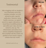 FirstBase Duo Set before and after — reduced redness  brighter and more hydrated skin in 10 days